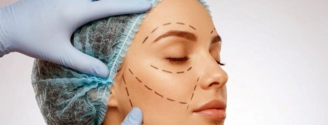 BeautyHealth Securities Settlement