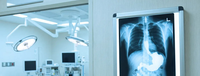 $40 million CAMC bariatric-surgery settlement offers two payment paths